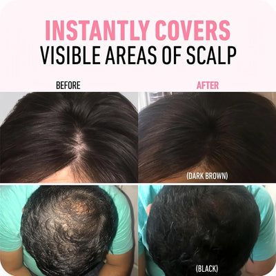 Hairline Shadow Powder, pletfri, skjuler øjeblikkeligt hårgrænse og hårrødder, vandtæt hårlinjepudderfiller til et naturligt look, med plantesqualane.