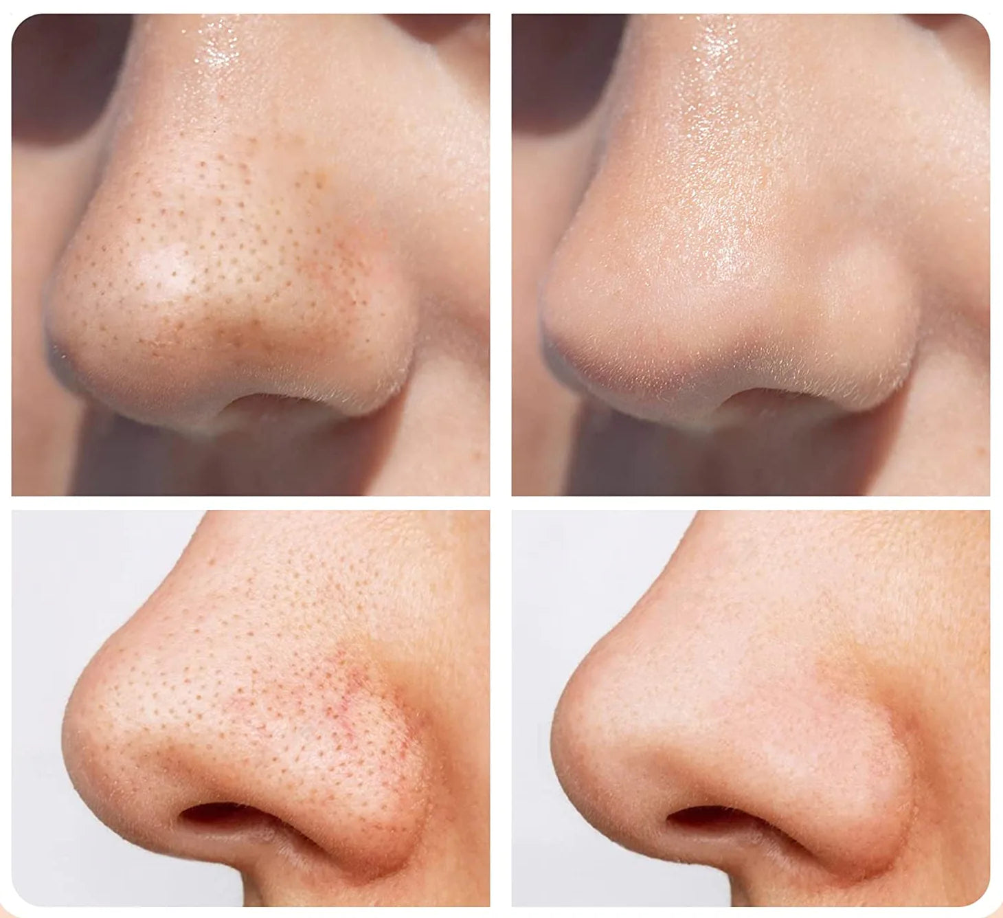 Derm Diamantsliber