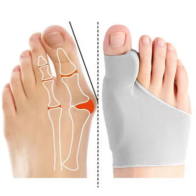 Tåseparator Hallux Valgus Knystkorrektor Hammertå Retter Fodsmertelindring Ortopædisk Pedicureværktøj Fodpleje