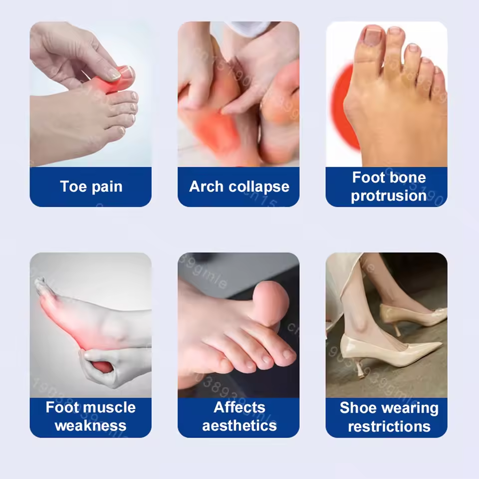 Elektrisk vibrationsmassager og knystkorrektor – Unisex fodskinne til hallux valgus med justerbar tåseparator og finger-tå korrektion