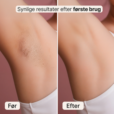 DuoShave – Elektrisk barbermaskine til kvinder