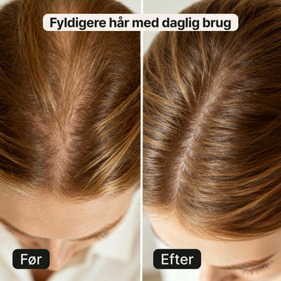 LED hårterapi-hat – Mod hårtab