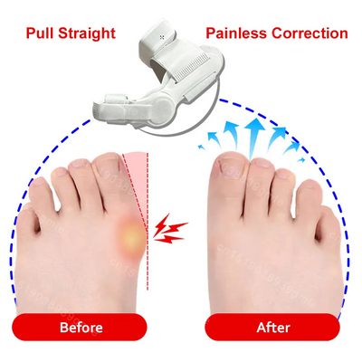 Elektrisk vibrationsmassager og knystkorrektor – Unisex fodskinne til hallux valgus med justerbar tåseparator og finger-tå korrektion